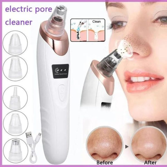 Electric Blackhead Remover Vacuum – Deep Pore Cleaner