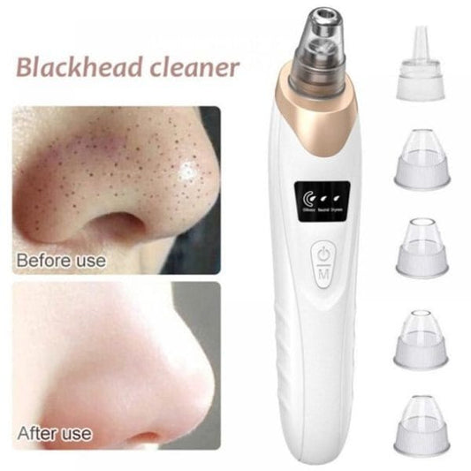Electric Blackhead Remover Vacuum – Deep Pore Cleaner